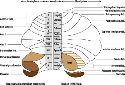 Cerebellar Gray Matter Volume in Tinnitus